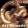 Baby - 15.5 Weeks