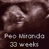 Baby -33 Weeks